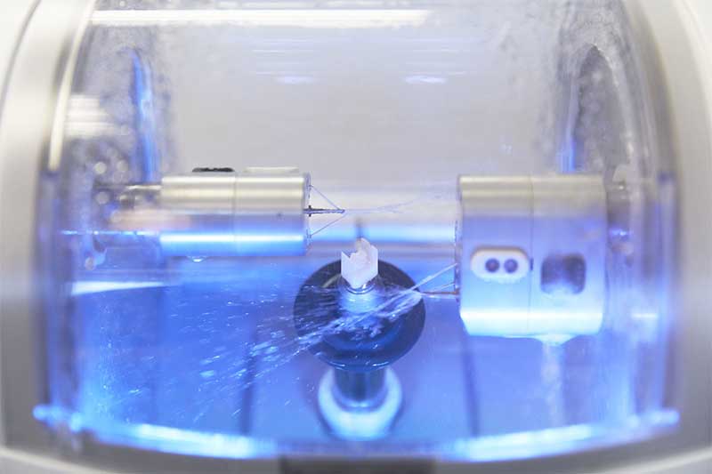 Dental Implants The Permanent Solution To Tooth Loss